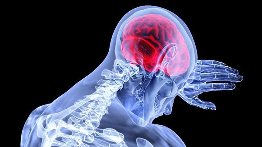 Prevenir el ICTUS: Claves para las personas mayores de 50 años