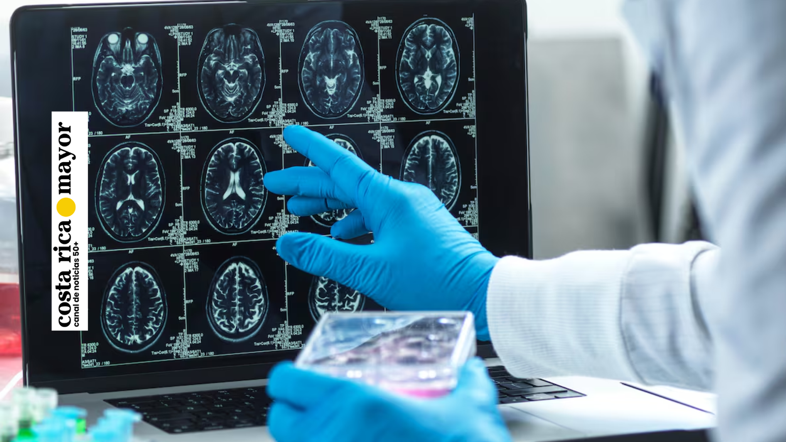 Las cinco “edades” del cerebro humano: cambios cruciales ocurren alrededor de los 9, 32, 66 y 83 años