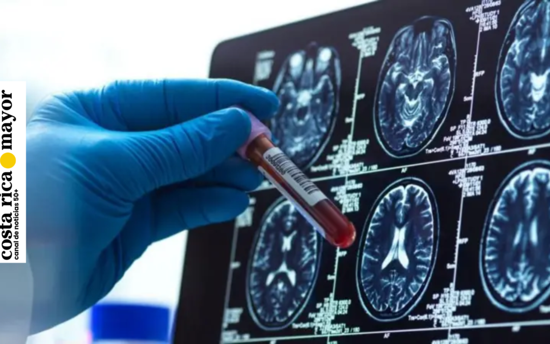 Alzheimer: cuatro avances esperanzadores que abren una nueva etapa en 2025