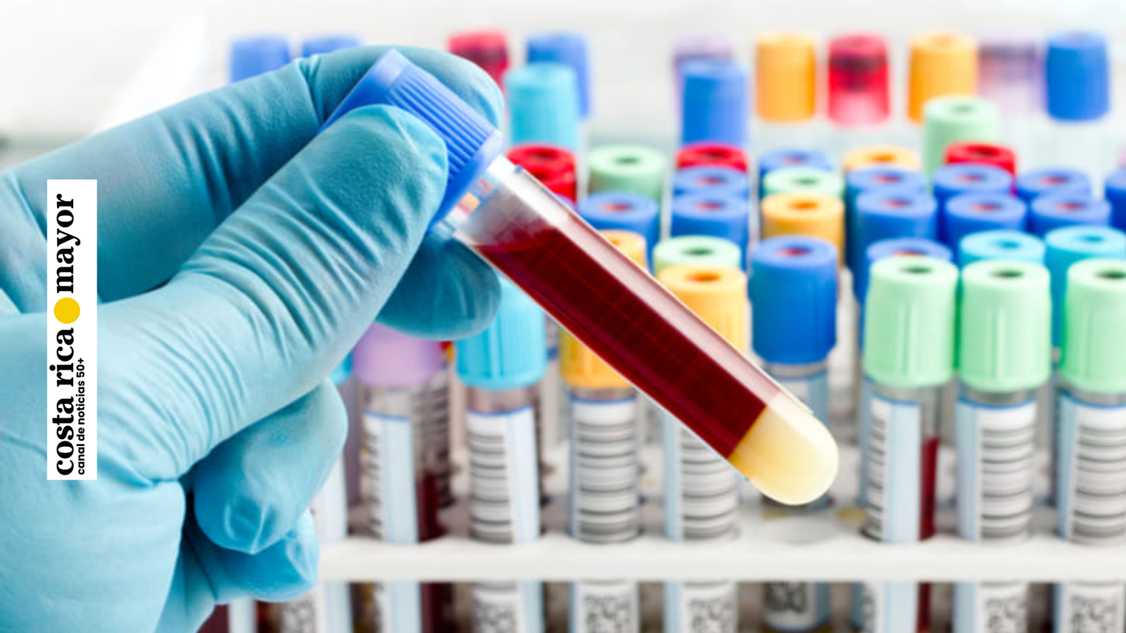 Costa Rica da un paso histórico en la detección temprana del cáncer con una prueba de sangre