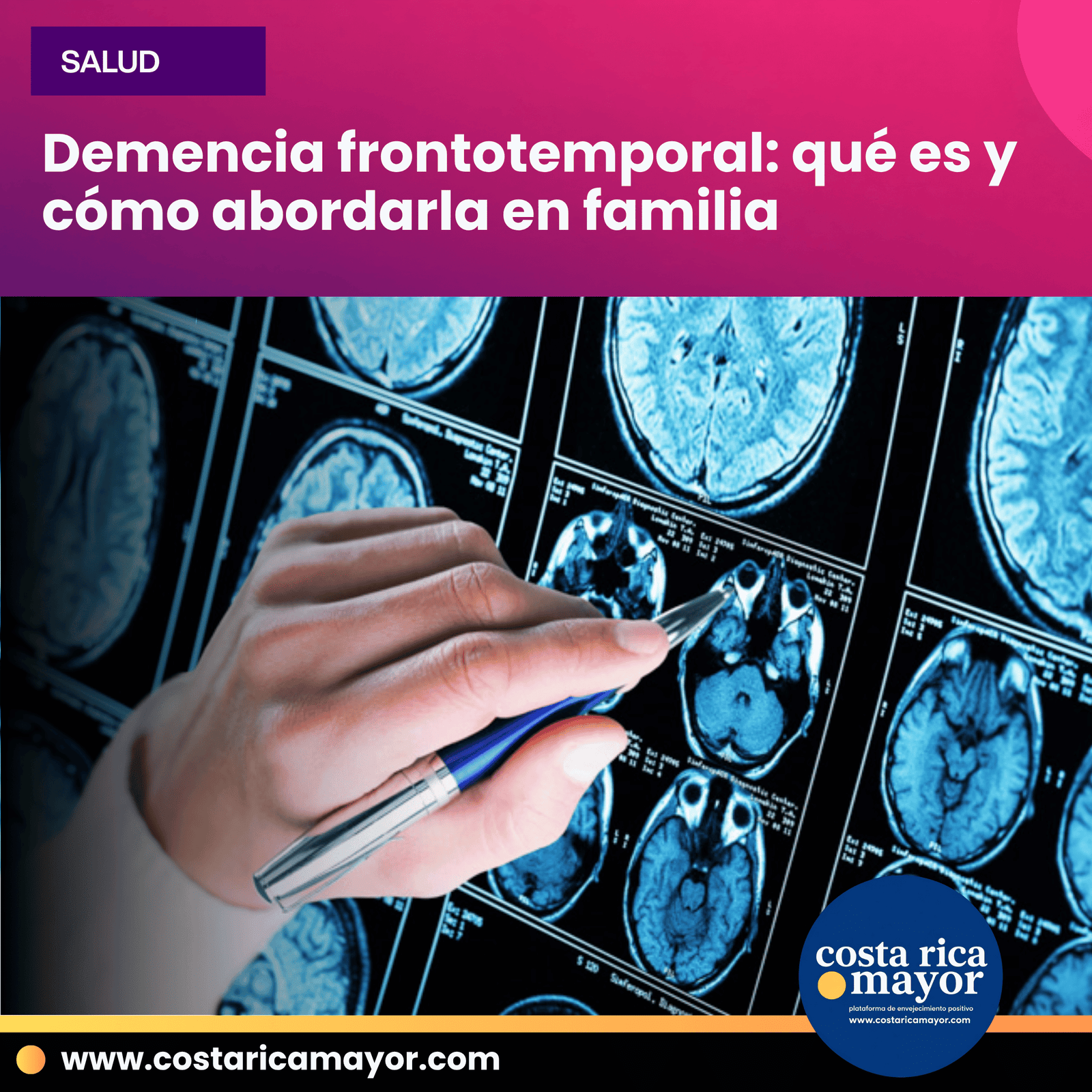 Demencia frontotemporal: qué es y cómo abordarla en familia